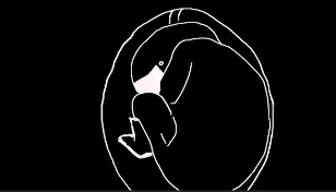 It's your mom's ultrasound