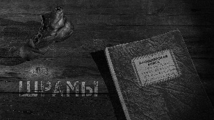 Шрамы